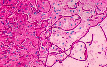 Bacillus thuringiensis Wirtz stain