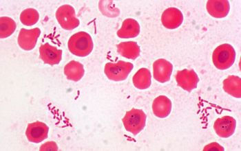 Bacteroides fragilis Gram stain