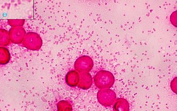 Bacteroides stercoris Gram stain