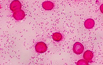 Bacteroides uniformis Gram stain