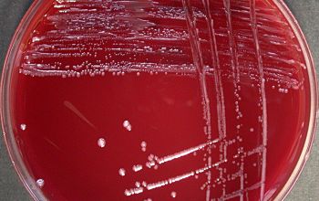 Bacteroides stercoris Brucella Blood Agar 48h culture anaerobicly incubated