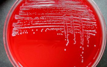 Bacteroides vulgatus (Phocaeicola vulgatus) Brucella Blood Agar 48h culture anaerobicly incubated