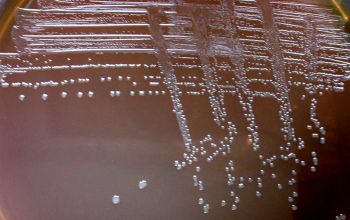 Bacteroides vulgatus (Phocaeicola vulgatus)  culture anaerobicly incubated