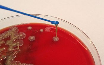 Bergeyella zoohelcum Blood Agar 48h culture 