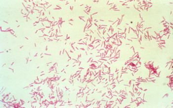 Bergeyella zoohelcum Gram stain