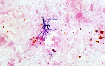 Bifidobacterium species Gram stain