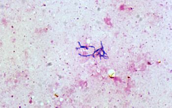 Bifidobacterium species Gram stain