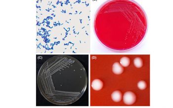 Bifidobacterium species Blood Agar 48h culture incubated with CO2