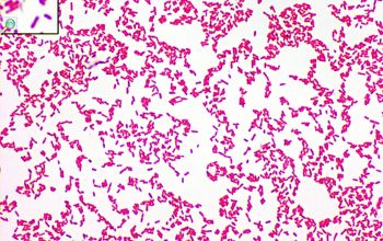 Bordetella bronchoseptica Gram stain