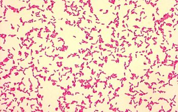 Bordetella bronchoseptica Gram stain