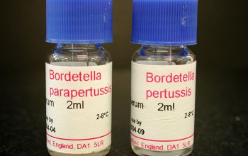 Bordetella parapertussis  culture 