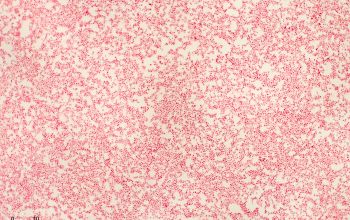 Bordetella parapertussis Gram stain