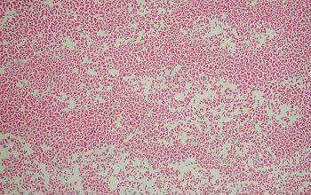 Bordetella pertussis Gram stain