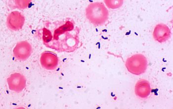 Brevibacterium casei Gram stain