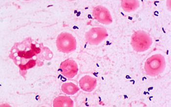 Brevibacterium casei Gram stain