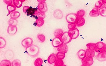 Brevibacterium casei Gram stain