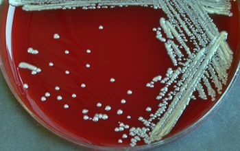 Brevundimonas vesicularis Blood Agar 48h culture incubated with O2