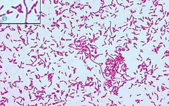 Brevundimonas vesicularis Gram stain