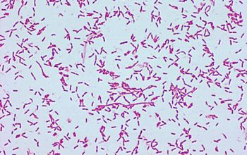 Brevundimonas vesicularis Gram stain