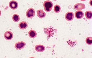 Brucella melitensis Gram stain