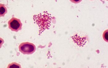 Brucella melitensis Gram stain