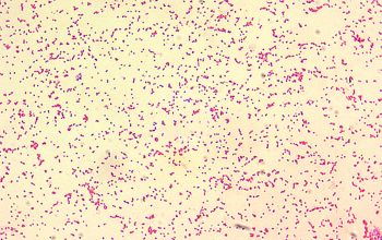 Brucella melitensis Gram stain