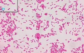 Burkholderia cenocepacia Gram stain