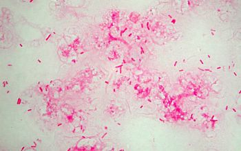 Burkholderia cepacia Gram stain