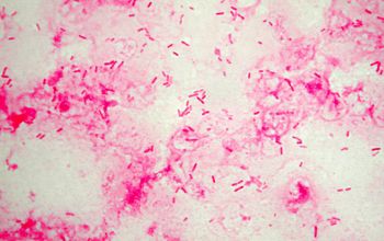 Burkholderia cepacia Gram stain