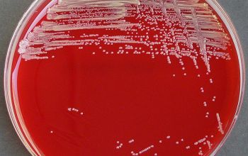 Burkholderia cepacia Blood Agar 24h culture incubated with O2