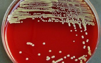 Burkholderia cepacia Blood Agar 48h culture incubated with O2