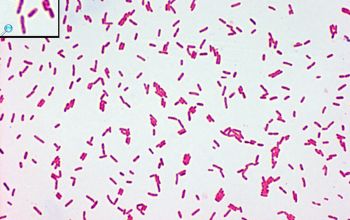 Burkholderia cepacia Gram stain