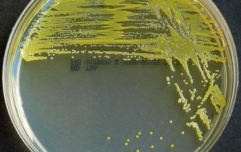 Burkholderia cepacia  culture incubated with O2