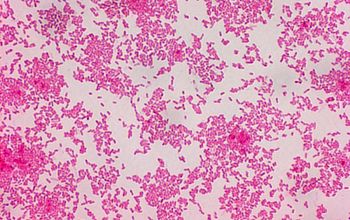 Burkholderia multivorans Gram stain