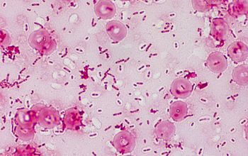 Burkholderia pseudomallei Gram stain