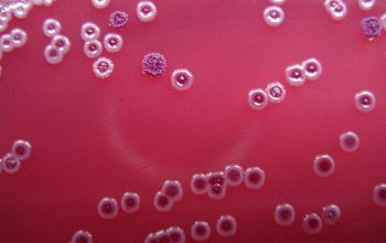 Burkholderia pseudomallei  culture incubated with O2