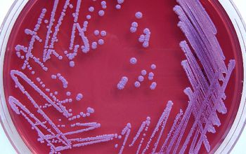 Burkholderia pseudomallei  culture incubated with O2