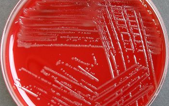 Campylobacter coli Blood Agar 48h culture micro-aerophillic