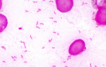 Campylobacter coli Gram stain