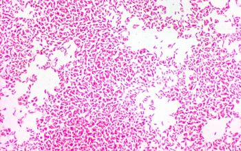 Campylobacter coli Gram stain