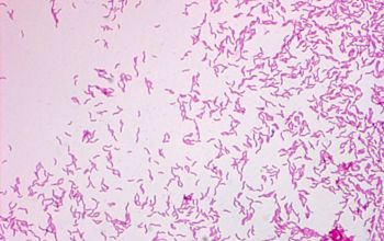 Campylobacter fetus Gram stain