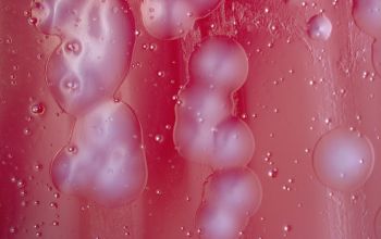 Campylobacter jejuni  culture micro-aerophillic