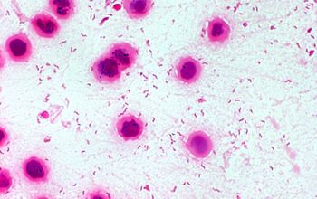 Campylobacter jejuni Gram stain