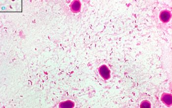 Campylobacter jejuni Gram stain