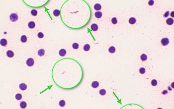 Campylobacter jejuni 