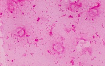 Campylobacter lari Gram stain