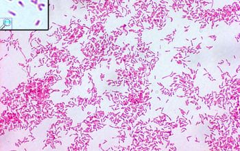 Campylobacter ureolyticus Gram stain