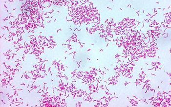 Campylobacter ureolyticus Gram stain