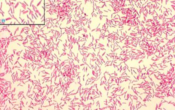 Capnocytophaga canimorsus Gram stain