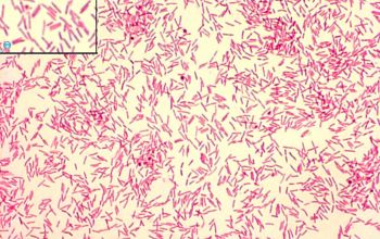 Capnocytophaga canimorsus Gram stain